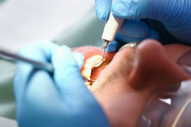Best Emergency Tooth Extraction  in Lawton, OK