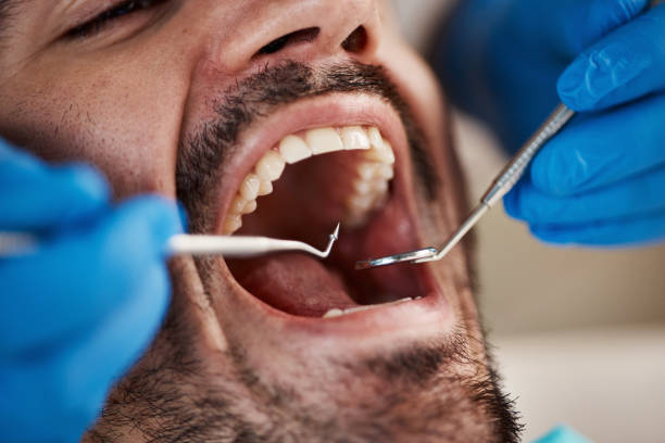 Best Dentist for Tooth Abscess  in Lawton, OK